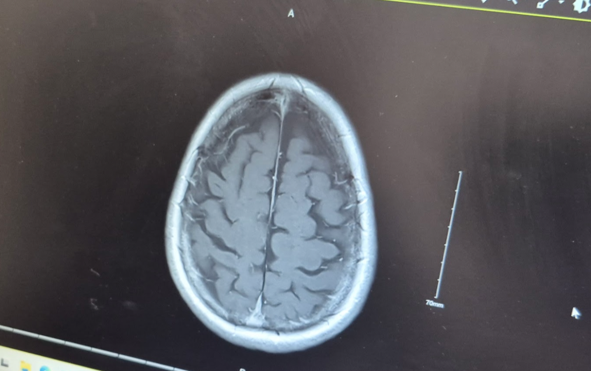 DD's brain (or a bit of it)